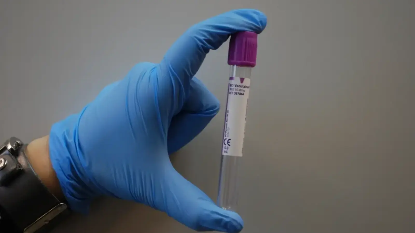 A gloved hand holding a blood collection tube